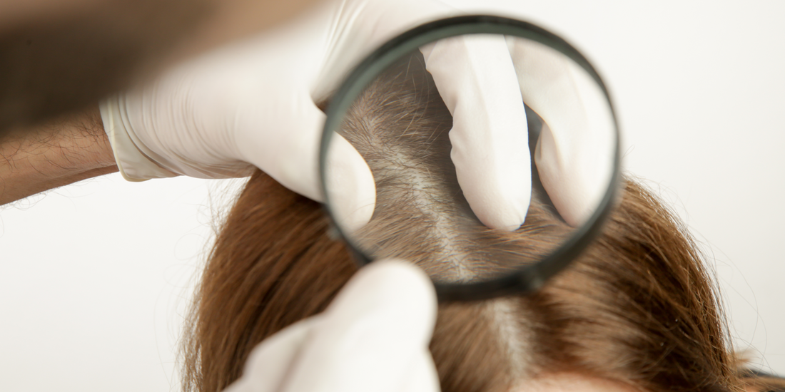 woman's scalp being inspected by a doctor